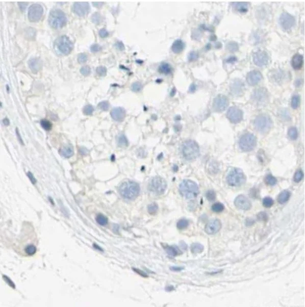 Immunohistochemistry (Formalin/PFA-fixed paraffin-embedded sections) - Anti-TRP2/DCT antibody (AB223736)