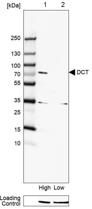 Western blot - Anti-TRP2/DCT antibody (AB223736)