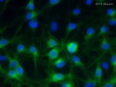 Immunocytochemistry/ Immunofluorescence - Anti-TRP2/DCT antibody (AB74073)