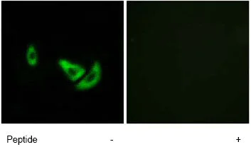 Immunocytochemistry/ Immunofluorescence - Anti-TRP2/DCT antibody (AB74073)