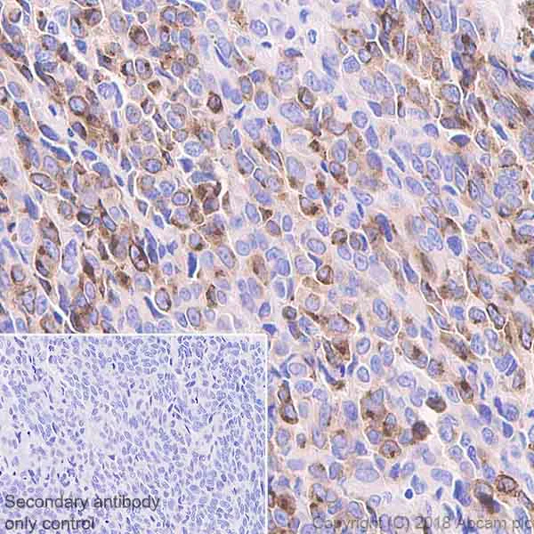 Immunohistochemistry (Formalin/PFA-fixed paraffin-embedded sections) - Anti-TRP2/DCT antibody [EPR21986] (AB221144)
