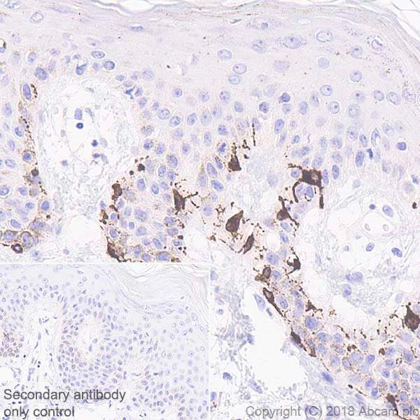 Immunohistochemistry (Formalin/PFA-fixed paraffin-embedded sections) - Anti-TRP2/DCT antibody [EPR21986] (AB221144)
