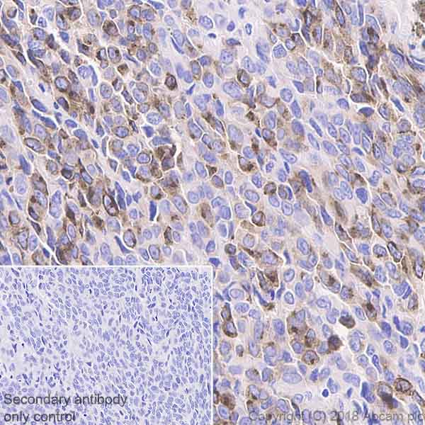 Immunohistochemistry (Formalin/PFA-fixed paraffin-embedded sections) - Anti-TRP2/DCT antibody [EPR21986] - BSA and Azide free (AB234901), expandable thumbnail