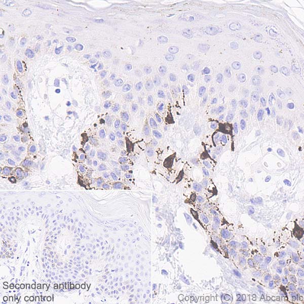 Immunohistochemistry (Formalin/PFA-fixed paraffin-embedded sections) - Anti-TRP2/DCT antibody [EPR21986] - BSA and Azide free (AB234901), expandable thumbnail