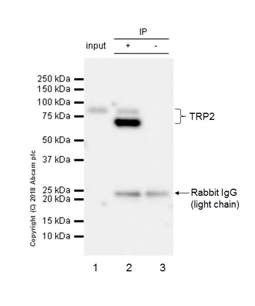 Immunoprecipitation - Anti-TRP2/DCT antibody [EPR21986] - BSA and Azide free (AB234901)