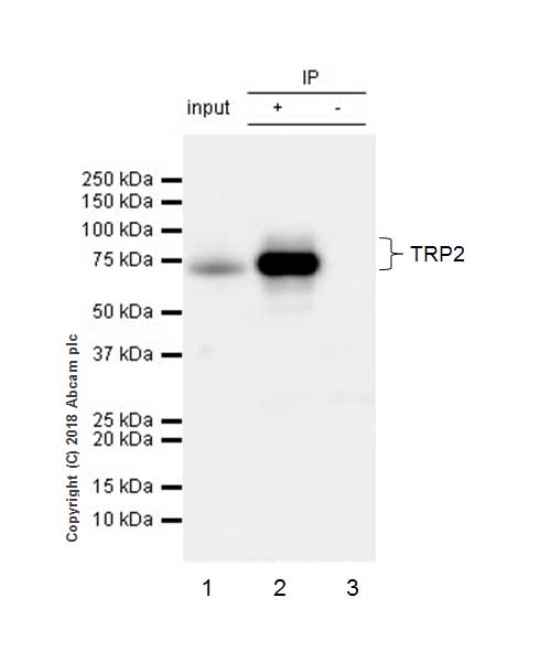 Immunoprecipitation - Anti-TRP2/DCT antibody [EPR21986] - BSA and Azide free (AB234901), expandable thumbnail