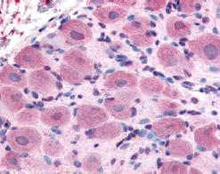 Immunohistochemistry (Formalin/PFA-fixed paraffin-embedded sections) - Anti-TRPA1/TSA antibody (AB62053)