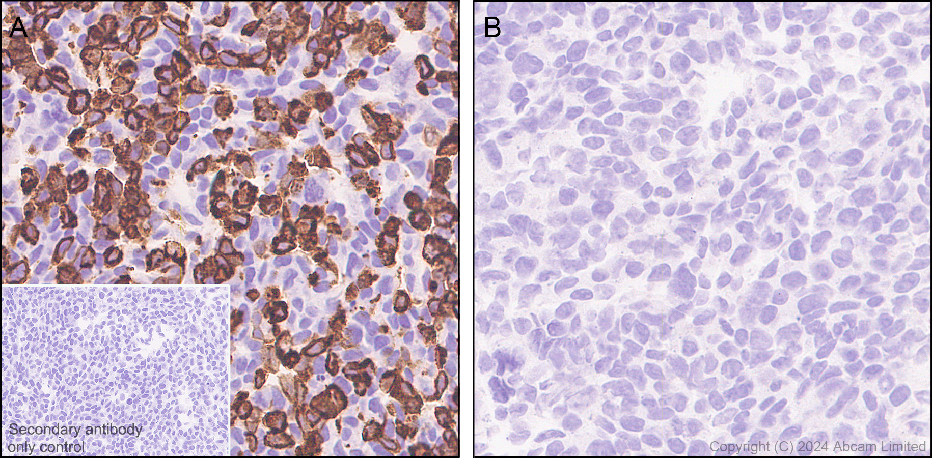Immunohistochemistry (Formalin/PFA-fixed paraffin-embedded sections) - Anti-TRPA1/TSA antibody [EPR26211-139] (AB320715)