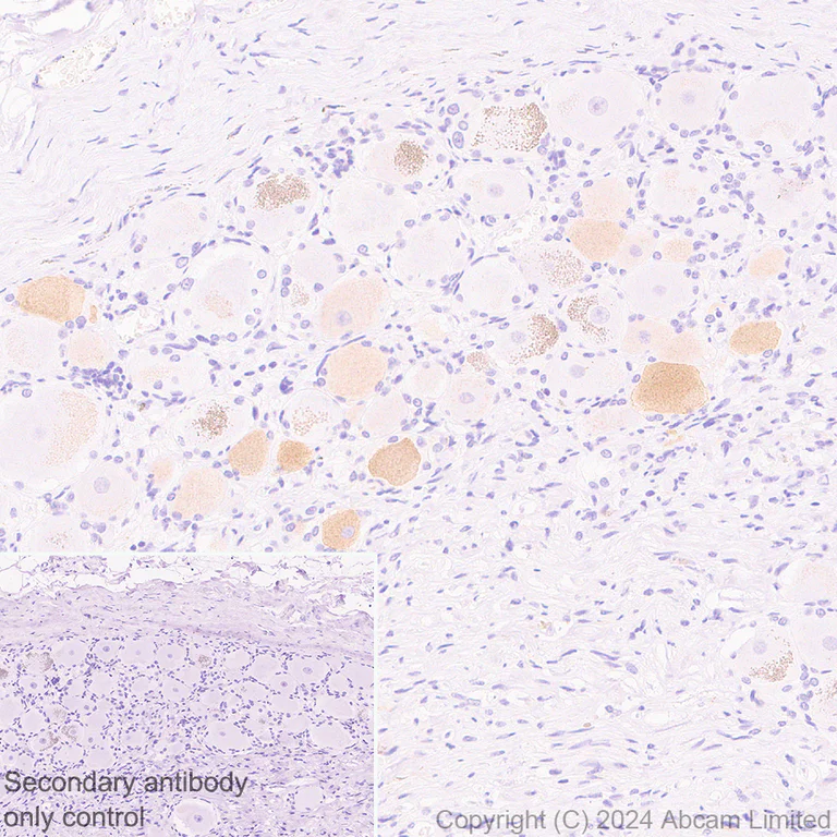 Immunohistochemistry (Formalin/PFA-fixed paraffin-embedded sections) - Anti-TRPA1/TSA antibody [EPR26211-139] - BSA and Azide free (AB320716)