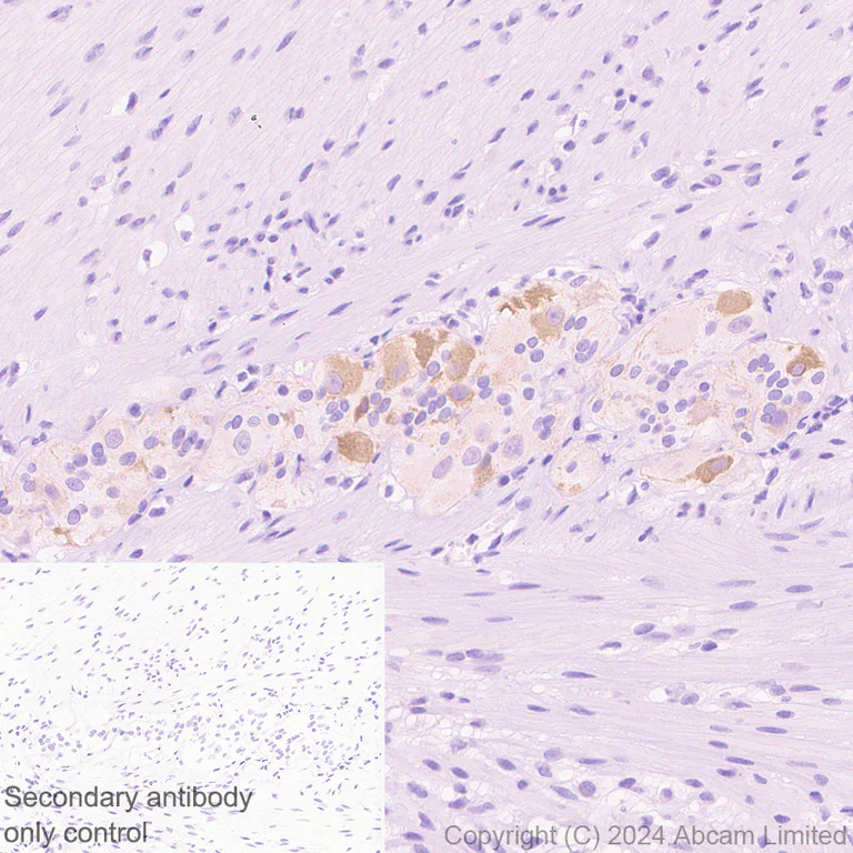 Immunohistochemistry (Formalin/PFA-fixed paraffin-embedded sections) - Anti-TRPA1/TSA antibody [EPR26211-139] - BSA and Azide free (AB320716)