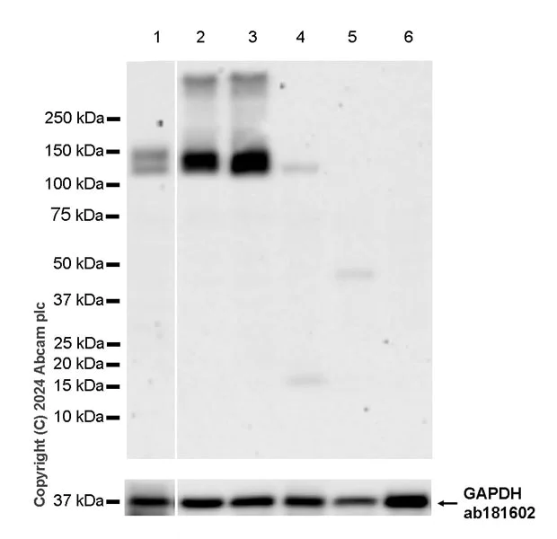 Western blot - Anti-TRPA1/TSA antibody [EPR26211-139] - BSA and Azide free (AB320716)