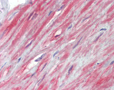 Immunohistochemistry (Formalin/PFA-fixed paraffin-embedded sections) - Anti-TRPC1 antibody (AB110837)