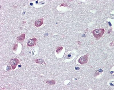 Immunohistochemistry (Formalin/PFA-fixed paraffin-embedded sections) - Anti-TRPC1 antibody (AB110837)