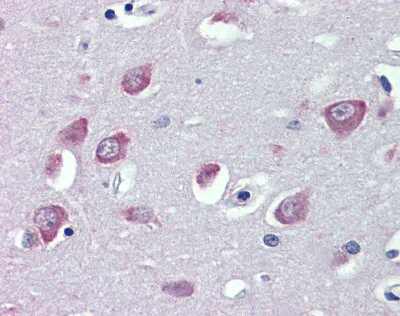 Immunohistochemistry (Formalin/PFA-fixed paraffin-embedded sections) - Anti-TRPC1 antibody (AB110837)