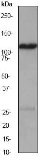 Western blot - Anti-TRPC1 antibody [EP1417Y] (AB51255)