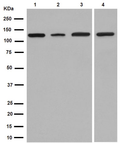 Western blot - Anti-TRPC1 antibody [EPR1417(2)] (AB192031)
