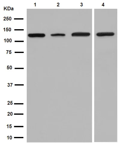 Western blot - Anti-TRPC1 antibody [EPR1417(2)] (AB192031)