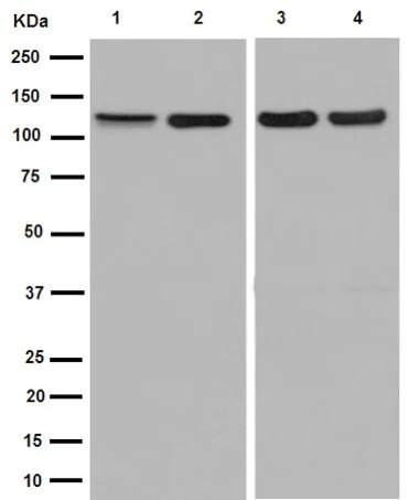 Western blot - Anti-TRPC1 antibody [EPR1417(2)] - BSA and Azide free (AB251109)