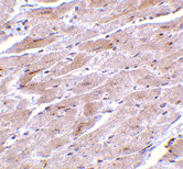 Immunohistochemistry (Formalin/PFA-fixed paraffin-embedded sections) - Anti-TRPC3 antibody (AB51560)