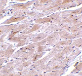 Immunohistochemistry (Formalin/PFA-fixed paraffin-embedded sections) - Anti-TRPC3 antibody (AB51560)