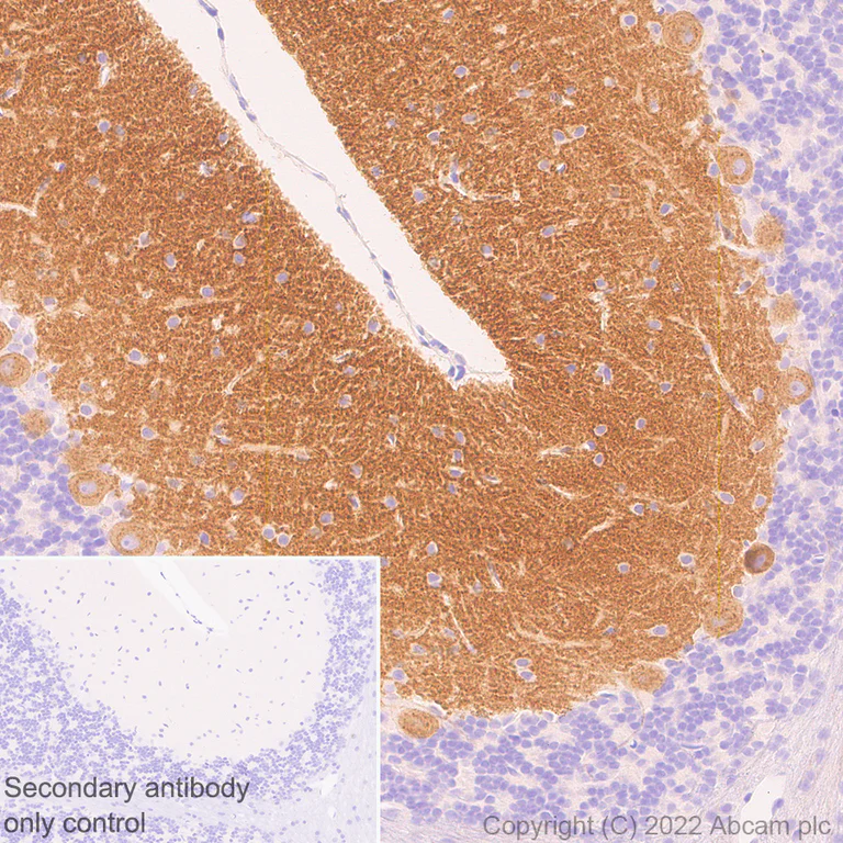 Immunohistochemistry (Formalin/PFA-fixed paraffin-embedded sections) - Anti-TRPC3 antibody [EPR25056-56] (BSA and Azide free) (AB300143)