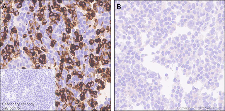 Immunohistochemistry (Formalin/PFA-fixed paraffin-embedded sections) - Anti-TRPC3 antibody [EPR25056-56] (BSA and Azide free) (AB300143)