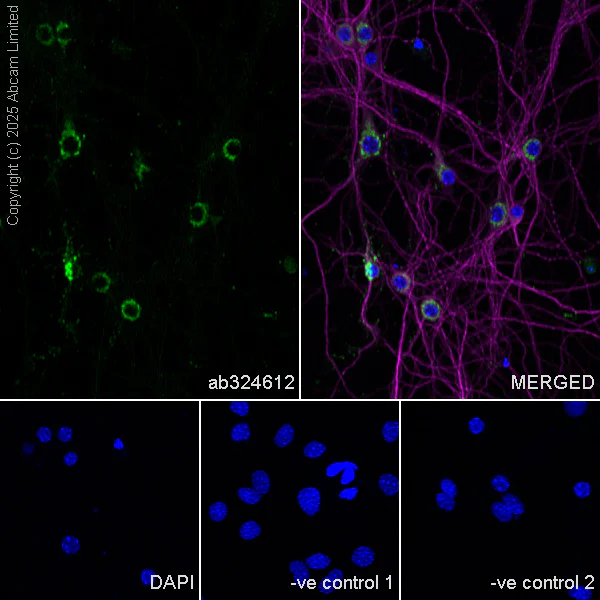 Immunocytochemistry/ Immunofluorescence - Anti-TRPC5 antibody [EPR29135-120] (AB324612)