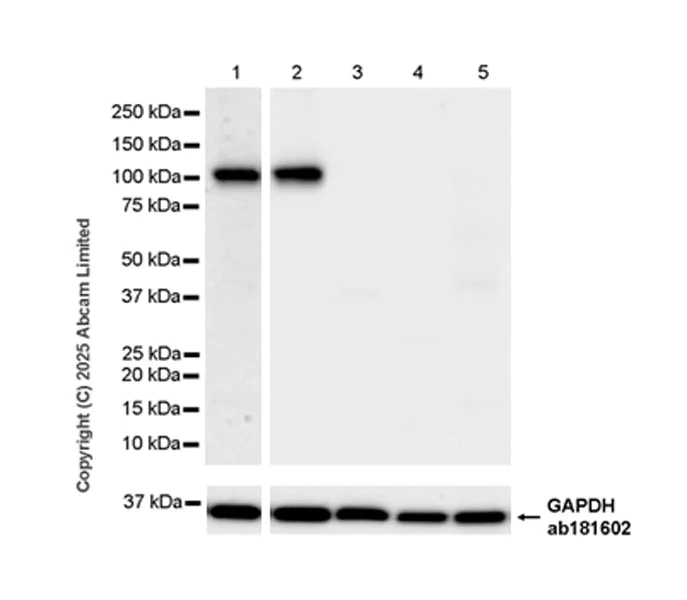 Western blot - Anti-TRPC5 antibody [EPR29135-120] (AB324612)