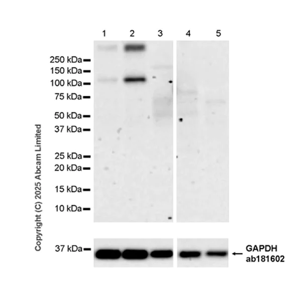 Western blot - Anti-TRPC5 antibody [EPR29135-120] (AB324612)
