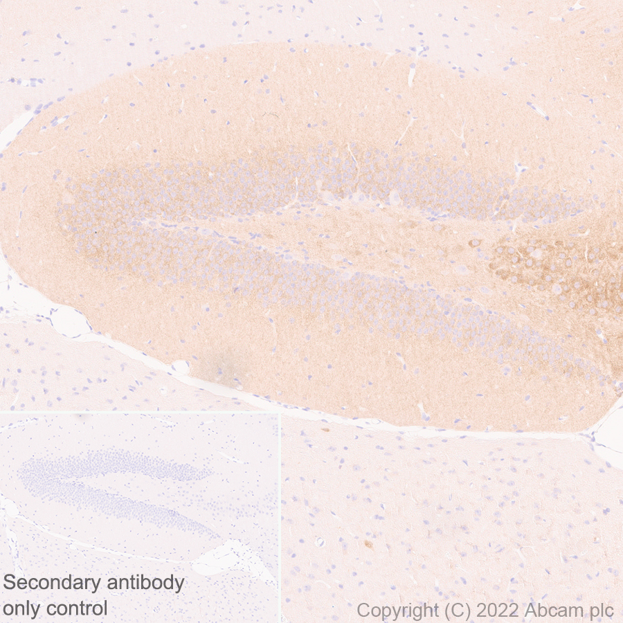 Immunohistochemistry (Formalin/PFA-fixed paraffin-embedded sections) - Anti-TRPC5 antibody [N67-15] - BSA and Azide Free (AB306596), expandable thumbnail