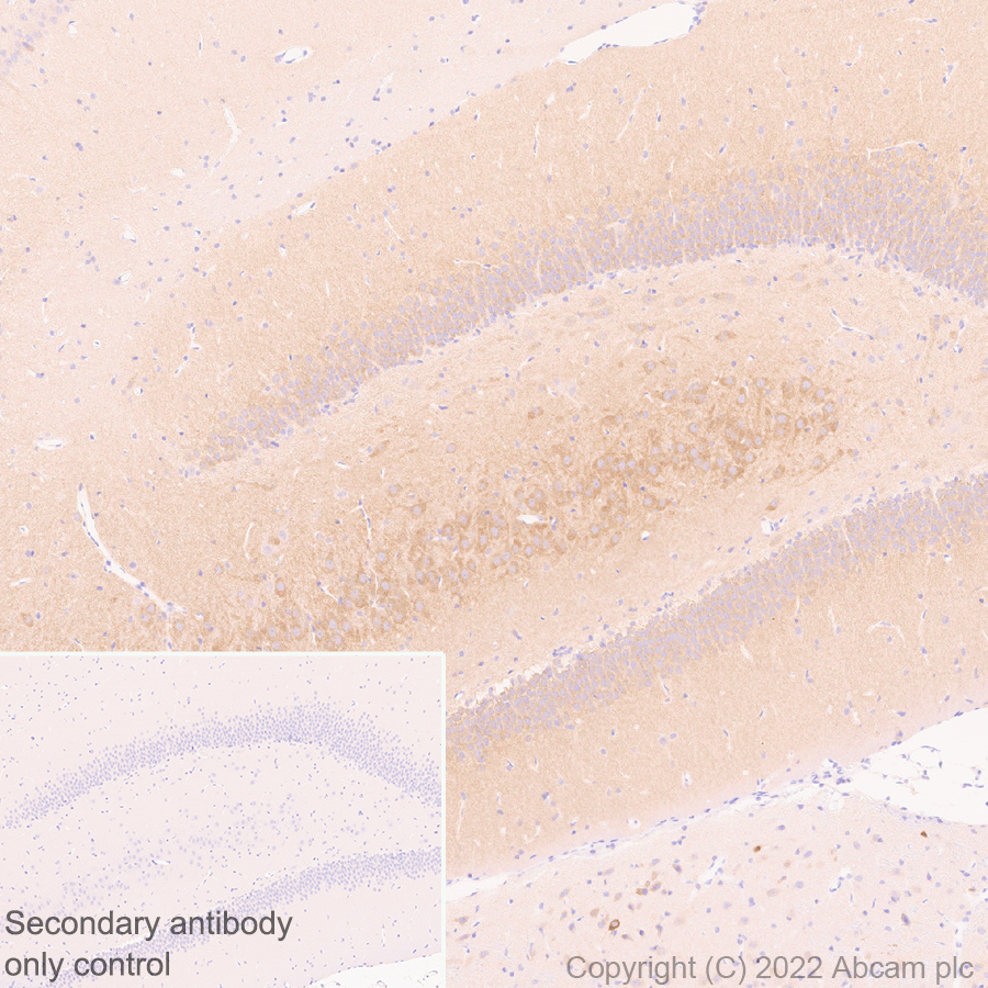 Immunohistochemistry (Formalin/PFA-fixed paraffin-embedded sections) - Anti-TRPC5 antibody [N67-15] - BSA and Azide Free (AB306596), expandable thumbnail