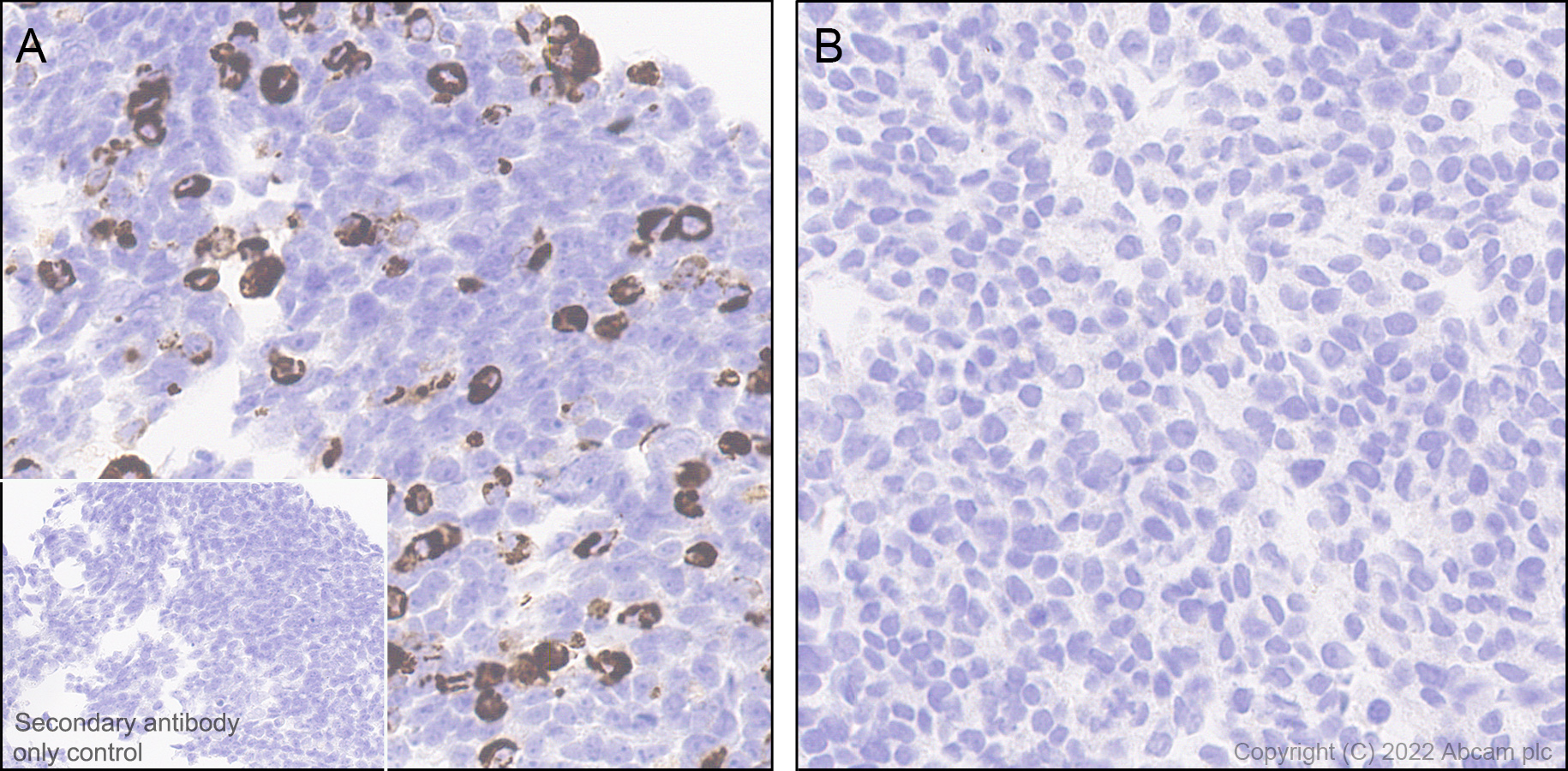 Immunohistochemistry (Formalin/PFA-fixed paraffin-embedded sections) - Anti-TRPC5 antibody [N67-15] - BSA and Azide Free (AB306596), expandable thumbnail