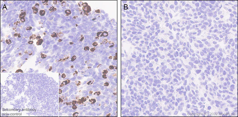 Immunohistochemistry (Formalin/PFA-fixed paraffin-embedded sections) - Anti-TRPC5 antibody [N67-15] - BSA and Azide Free (AB306596)