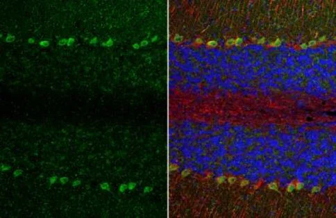 Immunohistochemistry (Formalin/PFA-fixed paraffin-embedded sections) - Anti-TRPC6 antibody (AB228771)