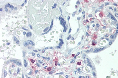 Immunohistochemistry (Formalin/PFA-fixed paraffin-embedded sections) - Anti-TRPC6 antibody (AB233413)
