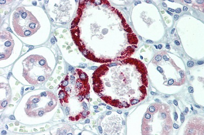 Immunohistochemistry (Formalin/PFA-fixed paraffin-embedded sections) - Anti-TRPC6 antibody (AB233413)
