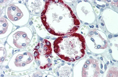 Immunohistochemistry (Formalin/PFA-fixed paraffin-embedded sections) - Anti-TRPC6 antibody (AB233413)