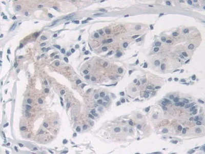 Immunohistochemistry (Formalin/PFA-fixed paraffin-embedded sections) - Anti-TRPC6 antibody (AB233413)