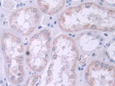 Immunohistochemistry (Formalin/PFA-fixed paraffin-embedded sections) - Anti-TRPC6 antibody (AB233413)