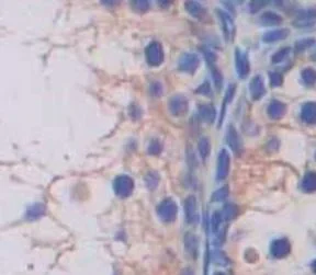 Immunohistochemistry (Formalin/PFA-fixed paraffin-embedded sections) - Anti-TRPC6 antibody (AB233413)