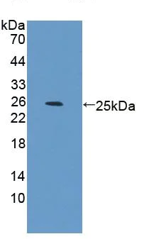 Western blot - Anti-TRPC6 antibody (AB233413)