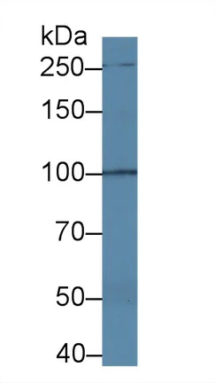 Western blot - Anti-TRPC6 antibody (AB233413)