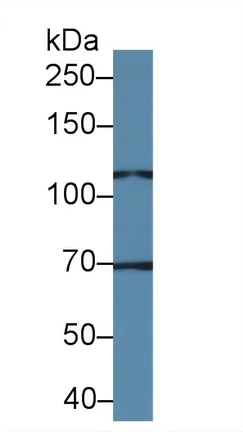 Western blot - Anti-TRPC6 antibody (AB233413)