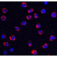 Immunocytochemistry - Anti-TRPC6 antibody (AB62461)
