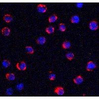 Immunocytochemistry - Anti-TRPC6 antibody (AB62461)