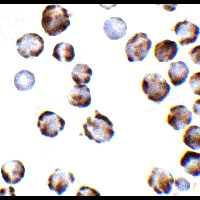 Immunocytochemistry - Anti-TRPC6 antibody (AB62461)