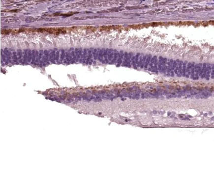 Immunohistochemistry (Formalin/PFA-fixed paraffin-embedded sections) - Anti-TRPM1 antibody (AB219965)