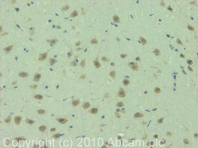 Immunohistochemistry (Formalin/PFA-fixed paraffin-embedded sections) - Anti-TRPM2 antibody (AB11168)