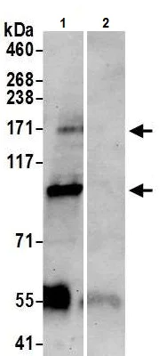Immunoprecipitation - Anti-TRPM2 antibody (AB11168)