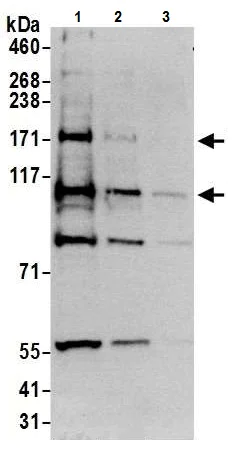 Western blot - Anti-TRPM2 antibody (AB11168)